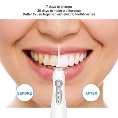 TOVENDOR Electric Water Flosser, Cordless Rechargeable Dental Oral Irrigator IPX7 Waterproof 300ML Travel Water Teeth Cleaner with 5 Tips for Braces Care Teeth Gums Cleaning, Home Office Daily Use - Image 8
