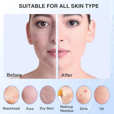 5 Modes Silicone Face Scrubber, Waterproof Face Scrubber Exfoliator for Men & Women, Rechargeable Electric Facial Cleansing Brush for Deep Cleansing, Exfoliating, Massage (Blue) - Image 6