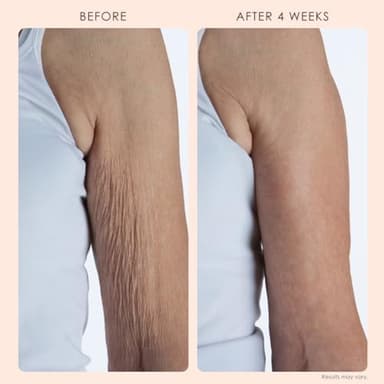 Body Firm Crepe Erase Body Repair Treatment, Anti Aging Firming Lotion with Collagen Peptides, Shea Butter, Vitamin E & Squalane, Cream For Women's Collagen Production, Citrus Scent, 10 Oz - Image 3