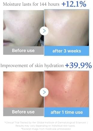 medicube Hyaluronic Multi Peptide PDRN Serum for Glowing and Soothing | Lightweight Water Plumping Radiant Facial Serum for All Skin Type, Hydrating Moisturizer, Korean Skincare | 30ml 1.01fl.oz - Image 5