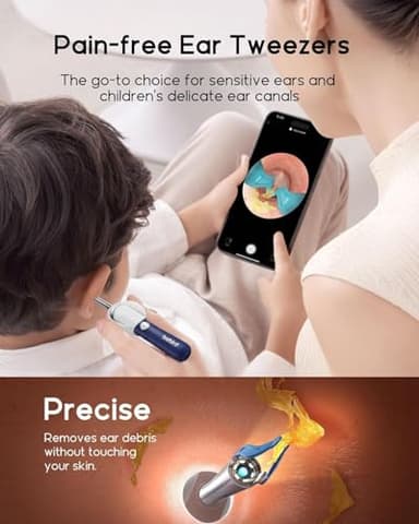 Bebird Earsight Plus D39R Ear Wax Removal Tool Camera, FSA HSA Eligible Items, Ear Cleaner with Flexible Ear Camera Otoscope, Visual Ear Pick Tweezers Wax Remover, Ear Cleaning Kit for Family - Image 4