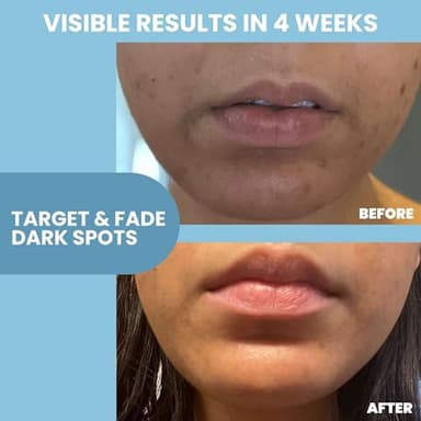 Eva Naturals Niacinamide 12% + Zinc Serum for Face – Dark Spot Remover, Pore Minimizer, Redness Relief, Hydrating Vitamin B3 with Botanical Hyaluronic Acid, Anti-Aging Facial Serum for Clear Skin - Image 3