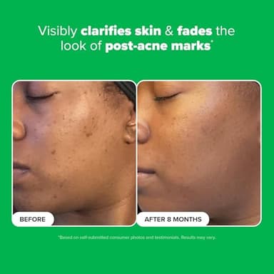 Paula's Choice BOOST 10% Azelaic Acid Booster Cream Gel Face Serum with Salicylic Acid, Oil-Free Skin Brightening Serum for Face, Fragrance-Free, 1oz - Image 4