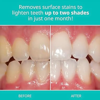 Opalescence Whitening Toothpaste Original Formula (Pack of 3) - Oral Care, Mint Flavor, Gluten Free - 4.7 Ounce - TP-5166-3 - Image 3