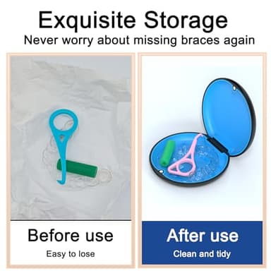 ARGOMAX - Upgrated Retainer Mouth Guards Travel Case Silicone Protection Inside - Image 5