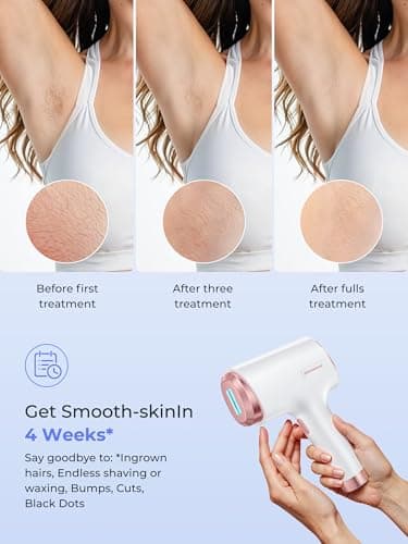 Ubroo Laser Hair Removal for Women & Men, 45°F Ice-Cooling Contact, Safe & Virtually Painless Alternative to Salon IPL Hair Removal Device, Long-Lasting Hair Removal from Home - Image 4