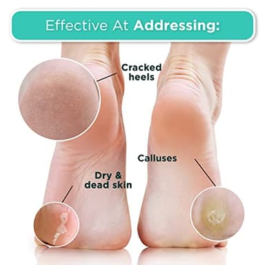 DERMORA Foot Peel Mask - 2 Pack of Regular Size Skin Exfoliating Foot Masks for Dry, Cracked Feet, Callus, Dead Skin Remover for Baby Soft Feet, Original Scent - Image 4