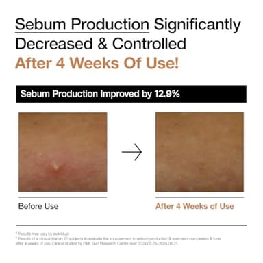 ANUA Rice 70 Glow Milky Toner, for Glass Skin, Rice Water, Niacinamide, Ceramides, Panthenol, Fragrance-Free, Non comedogenic, Fungal Acne Safe, Korean Skin Care, 250ml/8.45fl.oz. - Image 7