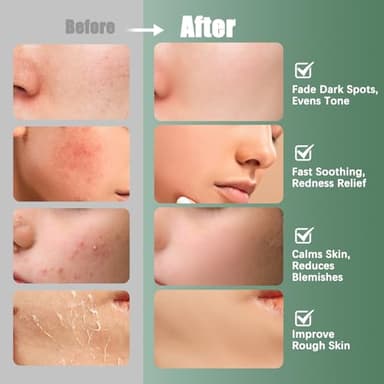 Kestper Madecassoside Toner Pads | 110 Pad Calming Face Pads with Centella Asiatica to Soothe,Balance Skin Tone,Fades Blemishes & Spots | Daily Face Skincare - Image 4