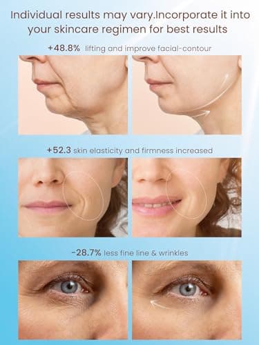 Radio Frequency Skin Tightening Device, Smart Electric Zinc Alloy Facial Beauty Machine with RF-Current Cold Heat for Jawline Lifting, Cheek Firm, Wrinkle Reduction, Depuff, Increase Absorption - Image 4