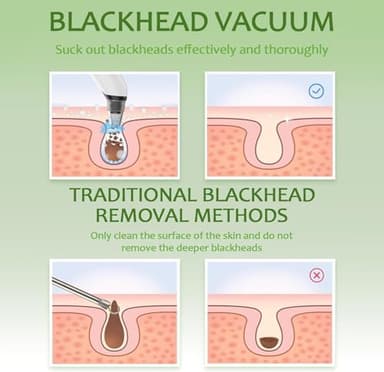 Blackhead Remover Pore Vacuum - Facial Pore Cleaner with 3 Adjustable Suction Levels, 4 Blackhead Removal Tools, Electric Acne Extractor Tool for Women & Men - Image 7