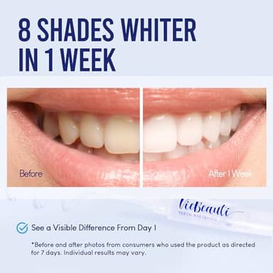 VieBeauti Teeth Whitening Kit with LED Light for Sensitive Teeth, 35% Carbamide Peroxide, Remineralizing Gel for Fast Results Mint - Image 2