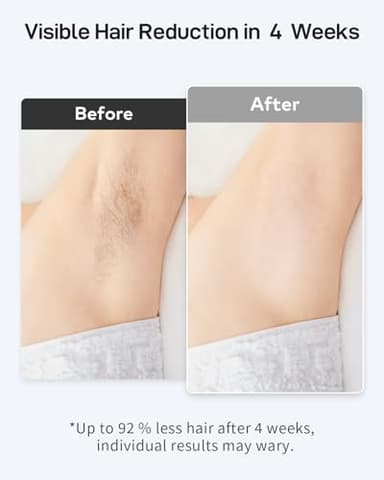 AMOTAOS IPL Laser Hair Removal for Women and Men, Ice-Cooling Laser Hair Removal Device Safe at-Home Epilators for Face Armpits Arms Bikini Line Legs Whole Body - Image 2