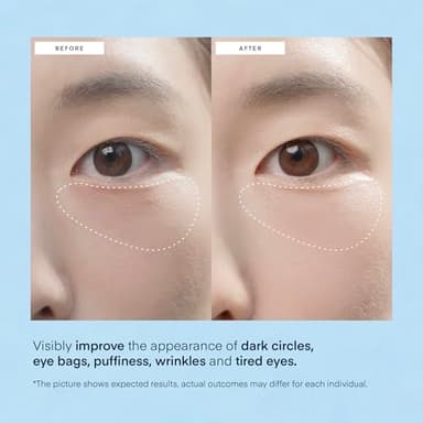 TEREZ & HONOR Under Eye Patches for Dark Circles - 60 Korean Hydrogel Masks for Puffiness, Bags with Caffeine, Hyaluronic Acid, Niacinamide - Undereye Brightening, Hydrating, Anti-Wrinkle & Cooling - Image 4
