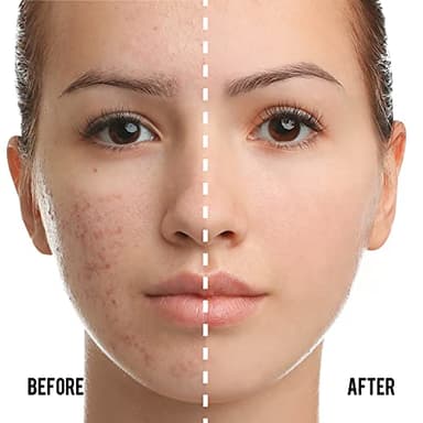 Catkin Phoenix Cushion Foundation Buildable Coverage Anti-Aging Serum Makeup, Sheer Satin Finish, Refill Included, Light Beige 0.46 Oz x 2, C01 NATURAL - Image 2