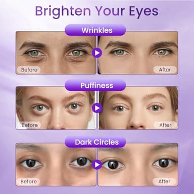 Retinol Eye Cream for Dark Circles and Puffiness, Hydrating Under Eye Cream for Dark Circles, Anti Aging Dark Circle Eye Cream for Fine Lines, Wrinkles, Firming Eye Contour, 1.06 oz - Image 6