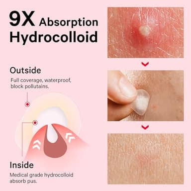 Sosky Pimple Patches for Face, Invisible Hydrocolloid Acne Patches, HSA Store Eligible Items, Zit Sticker for Face and Skin, Pimple Sticker for Covering Zits, Blemishes with Salicylic Acid 48 Count - Image 3