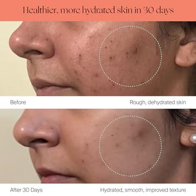 Canopy Bedside Evaporative Humidifier - 36 HR Run Time, 2.5L Capacity - No Mist - Help Alleviate Symptoms of Allergies, Flu, Cold, Dry Skin Includes Humidifier, Unwind Aroma, Filter - White - Image 6