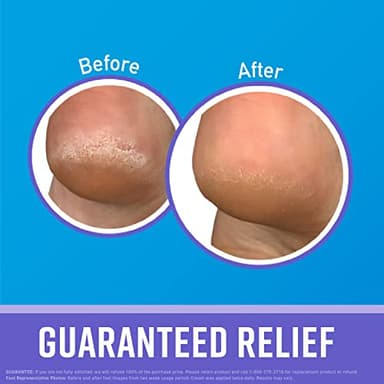 O'Keeffe's Working Hands Night Treatment Hand Cream and Healthy Feet Night Treatment Foot Cream, 7 Ounce Tube - Image 5