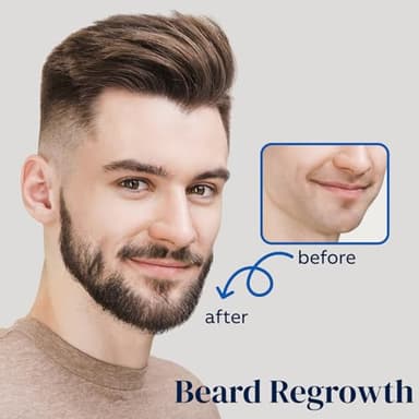 5% Minoxidil for Men Hair, Minoxidil for Women Hair Growth, Minoxidil Hair Growth Spray 2PCS. - Image 3