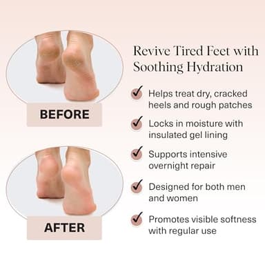 Kitsch Moisturizing Socks for Cracked Heel Treatment – Reusable Spa Socks for Women & Men with Insulated Gel Lining - Overnight Heel Socks for Dry Cracked Feet, Hydrating, Open-Toe Design - 1 Pair - Image 3