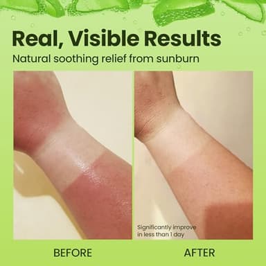 Honeyskin Soothing Aloe Vera Gel Made in the USA with Natural Ingredients - Give Yourself Relief From Sunburn and Dry Skin During the Hot Summer Days (8 Fl Oz) - Image 5