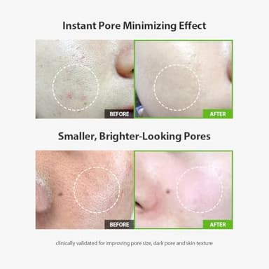 SUNGBOON EDITOR Green Tomato Pore Lifting Ampoule | Pore Minimizer Serum with Niacinamide & Green Tomato Extract | Hydrating & Firming Care for Sensitive Skin | Korean Skincare - Image 2