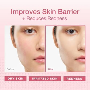 Physiogel Redness Reducing Cream – Ceramide Moisturizer for Dry, Sensitive & Redness-Prone Skin, Repairs Skin Barrier, Dermatologist-Tested, Fragrance-Free, Korean Skincare, 3.4 fl oz - Image 2