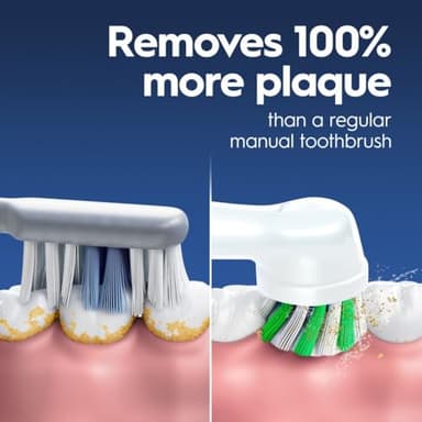 Oral-B Genius X Limited Rechargeable Electric Toothbrush with 1 Replacement Brush Head, Travel Case, White - Image 2