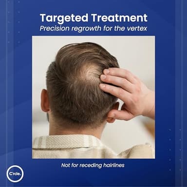 Minoxidil for Men Foam 5% - Unscented 3 Month Supply - Helps Restore Vertex Hair Loss & Thinning - 5% Minoxidil Foam For Men - Extra Strength Supports Hair Regrowth - Image 5