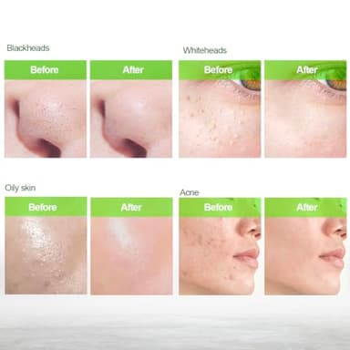 Blackhead Remover Mask, Charcoal Peel Off Face Mask, Blackhead Remover, Pore Cleaner for Men & Women, 2.7 fl oz - Image 4