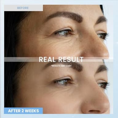 Retinol Eye Cream for Dark Circles: Anti-Wrinkle Under Eye Cream - Night Care Eye Cream Reduces Eye Bags - Image 4