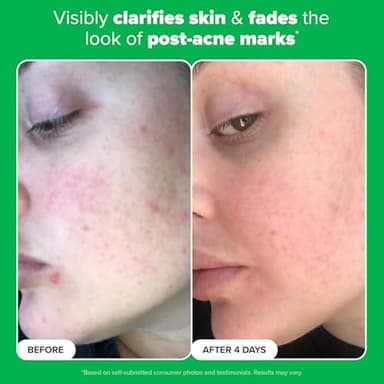 Paula's Choice BOOST 10% Azelaic Acid Booster Cream Gel Face Serum with Salicylic Acid, Oil-Free Skin Brightening Serum for Face, Fragrance-Free, 1oz - Image 5