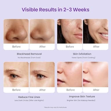 UNOISETION Diamond Microdermabrasion Machine Professional, 3 in 1 Dermabrasion Facial Peeling Skin Care Device for Salon Personal Home Use - Image 7