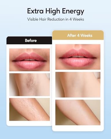 INNZA IPL Hair Removal with Ice Cooling Care Function for Women,Long-Lasting Results,999,999 Flashes Painless IPL Hair Remover, Hair Removal Device for Armpits Legs Arms Bikini Line - Image 4