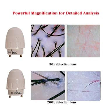 Professional Scalp Camera with 11-Inch HD Screen - High-Definition Hair & Scalp Analysis Device for Salons and Spas, Easy to Use with Memory Storage, Ideal for Scalp Treatments & Client Consultations - Image 2