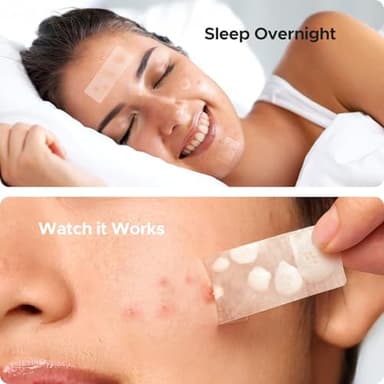 TKTK Large Pimple Patches for Face, 7 Sizes XL Acne Patches, Big Hydrocolloid Bandages for Body, Chin, Forehead, Chest, Back Zit Breakouts, Hydrocolloid Patch (Strip, Square, Dot 126 Count) - Image 4