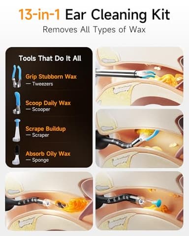 Anyear Flexible Ear Wax Removal Tool Camera, Wireless Ear Cleaner with 10MP HD Otoscope, Painless Tweezers, 12 Soft Tips, 3 Inspection Heads, Portable Earwax Removal Kit with Camera for Adults/Kids - Image 4