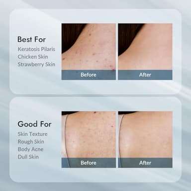 V11FACTORY AHA 12% Glycolic Acid Body Lotion – Korean Exfoliating & Hydrating Body Cream with Hyaluronic Acid & Collagen – Unscented, Paraben-Free Skin Smoothing Moisturizer, 10.6 oz - Image 7