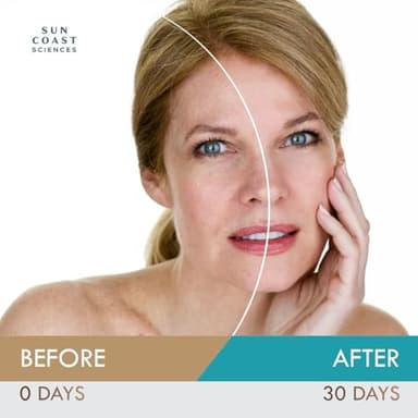 Dark Spot Diminisher, DermaBright MD, Age Spot Sun Spot Freckles Melasma Brown Spot Serum - Advanced Formula Corrector Cream for Women and Men - 1 Fl Oz (Pack of 1) - Image 5