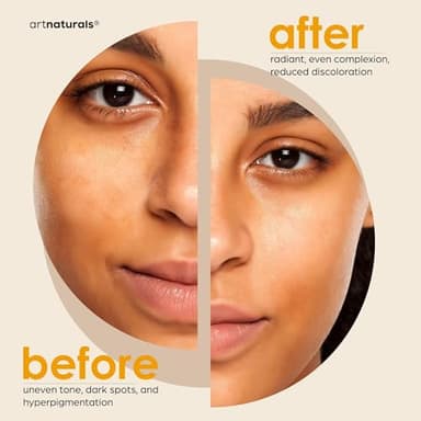 Kojic Acid Soap + African Net Sponge (2 pack X 142g Turmeric bars) Dark spot remover & Scars - Original Japanese Complex Vitamin C, Hyaluronic Acid, retinol, shea butter (Citrus) - Image 4