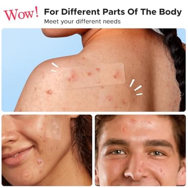 LitBear Large Pimple Patches, 5 Sizes 156 Patches Big Acne Patch, 60 XL Hydrocolloid Patch for Full Face, Forehead, Chin, Nose, Body, Back, Neck & Chest, Stirp, Square Large Hydrocolloid Bandages - Image 3