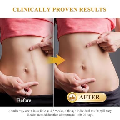 Silicone Scar Cream Scar Gel, Advanced Scar Cream for Surgical Scars, C-Section, Injury, Stretch Marks, Acne, Burns, Keloids, Old & New Scars, 1.85 Oz (55g) - Image 4