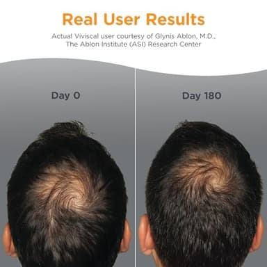 Viviscal Men's Hair Growth Supplements for Thicker Fuller Hair, Clinically Proven Collagen Complex, 180 Tablets 3 Month Supply - Image 3