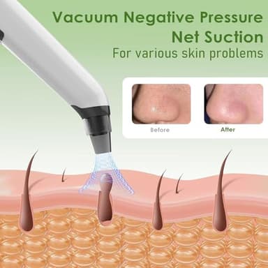 Blackhead Remover Pore Vacuum - Facial Pore Cleaner with 3 Adjustable Suction Levels, 4 Blackhead Removal Tools, Electric Acne Extractor Tool for Women & Men - Image 4