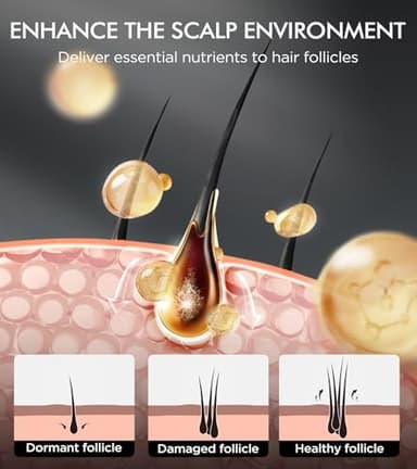 Hair Growth Biotin Shampoo and Conditioner Set, Onion Anti-Loss Volumizing Moisturizing Treatment for Soft Shine Hair, Rosemary Clarifying Dandruff Shampoo for Women Men, 2 x 16.9oz - Image 3