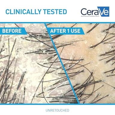 CeraVe 2 In 1 Hydrating Anti Dandruff Shampoo And Conditioner, 1% Pyrithione Zinc Dandruff Treatment, Color Safe & Sulfate Free Shampoo And Conditioner, Helps Eliminate Dandruff & Relieve Itchy Scalp - Image 4