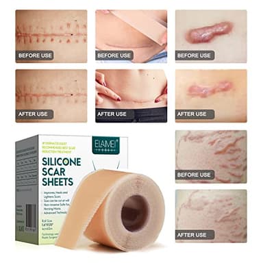 Silicone Scar Sheets (1.6” x 120” Roll-3M), Silicone Scar Tape Roll, Scar Silicone Strips, Reusable, Professional Scar Removal Sheets for C-Section, Surgery, Burn, Keloid, Acne et - Image 9