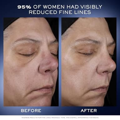 Lancôme Génifique Ultimate Dual Recovery Face Serum- Anti-Aging Serum Visibly Improves Fine Lines, Rough Texture, Plumpness and Even Skintone - with Beta Glucan and, Hyaluronic Acid - 1 Fl Oz - Image 4