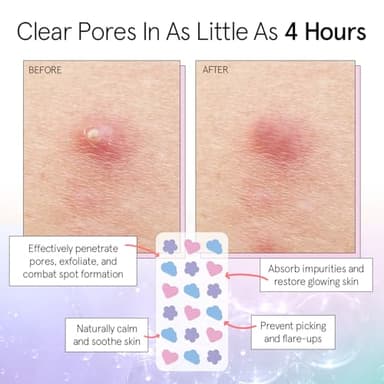 grace & stella Award Winning Pore Strip - Pimple Patches for Face - Hydrocolloid Acne Patches - Absorbs Zits, Reduces Redness - Cute Patches Dermatologist-Tested, Vegan (Multishape, 36 Count) - Image 3